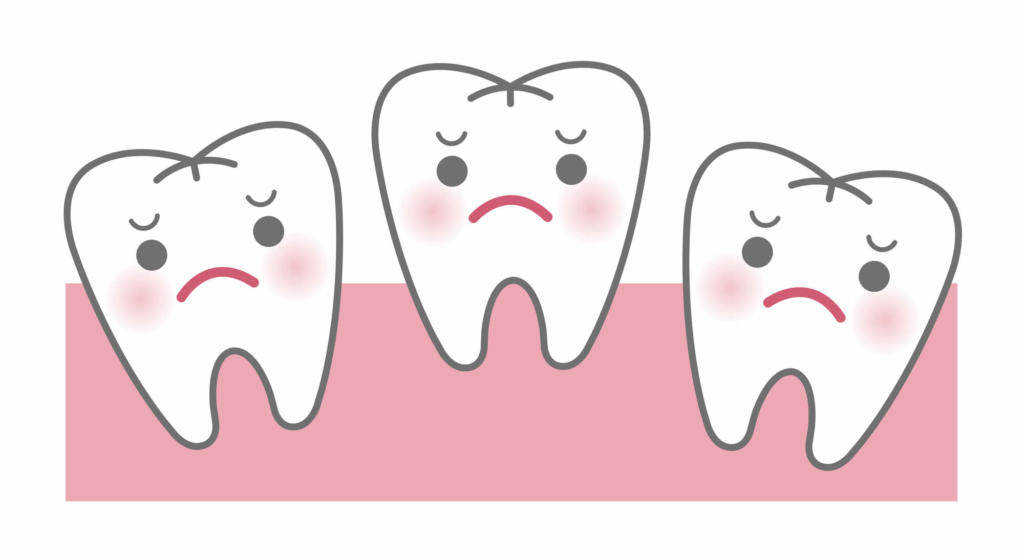 歯並びが悪い原因と歯列矯正